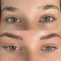 Hautverjüngungs-Roller TM